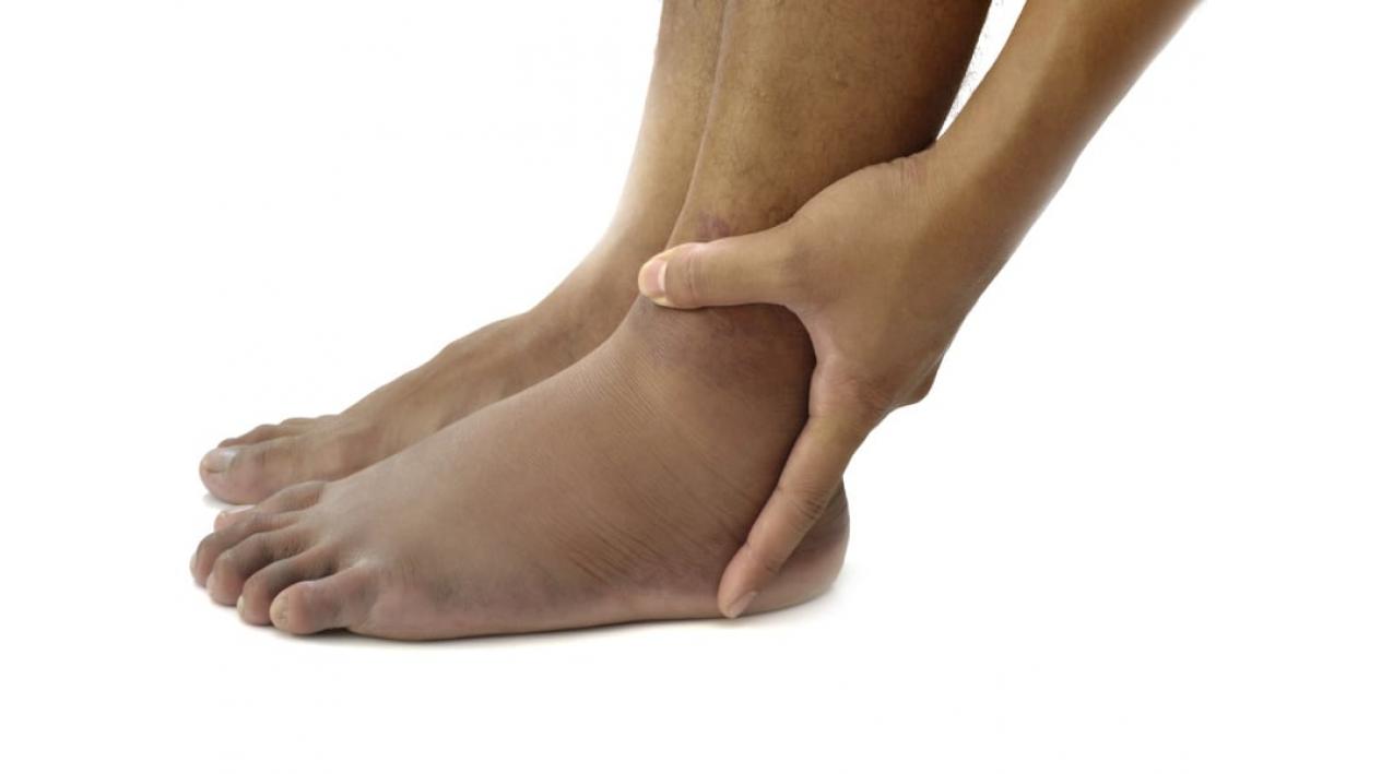 cauze picioare umflate durere în articulația de arțar